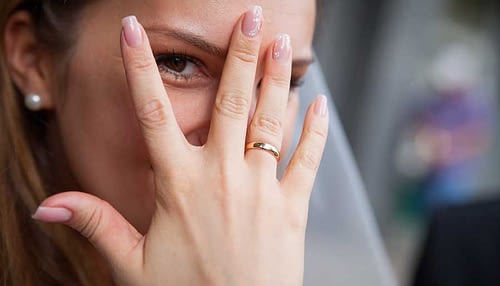 crean-dental-wedding-packages