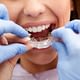 Which is better invisalign or metal braces?