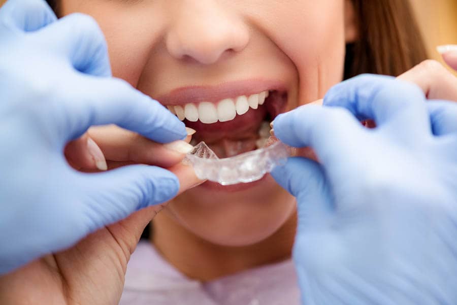 Which is better invisalign or metal braces?