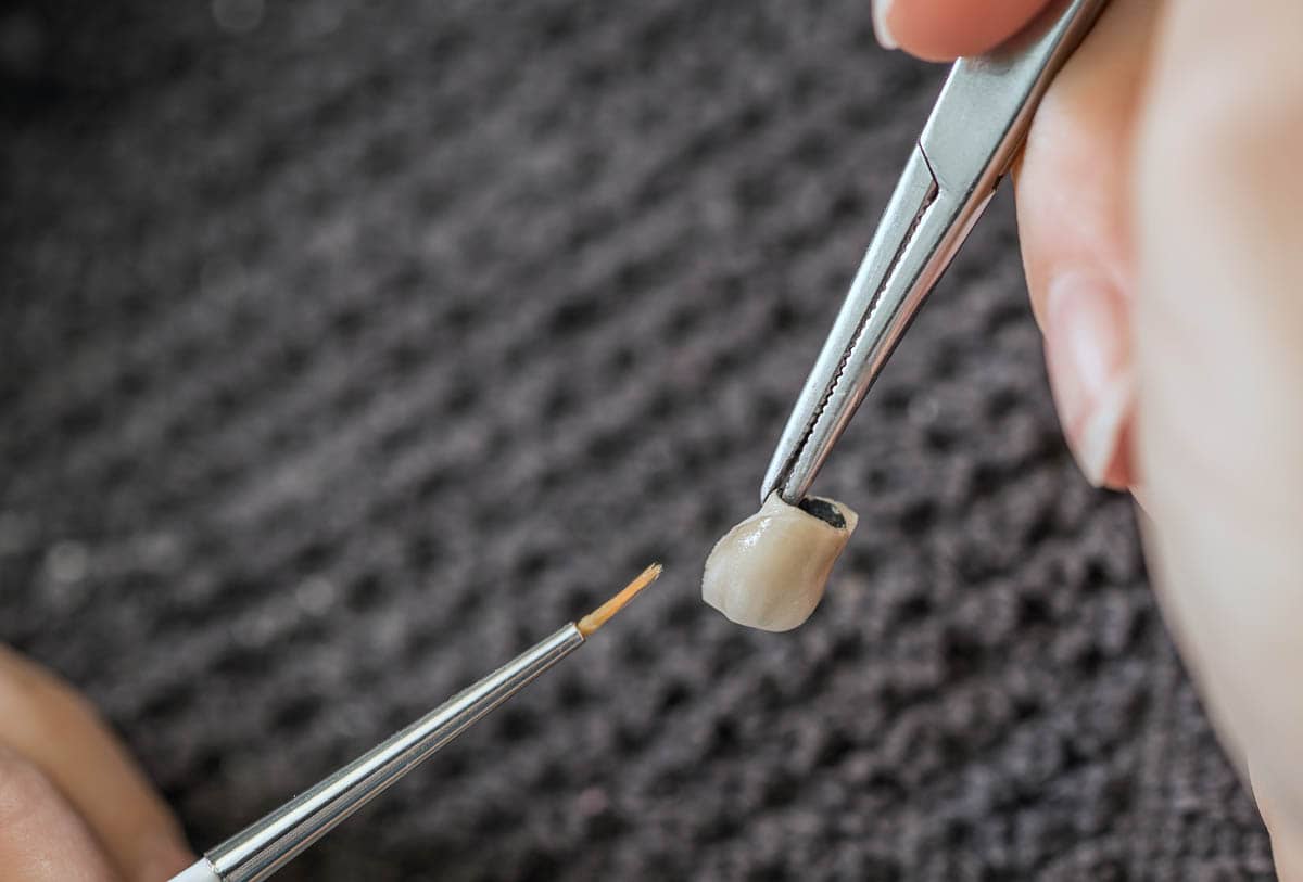 Paint a tooth crown